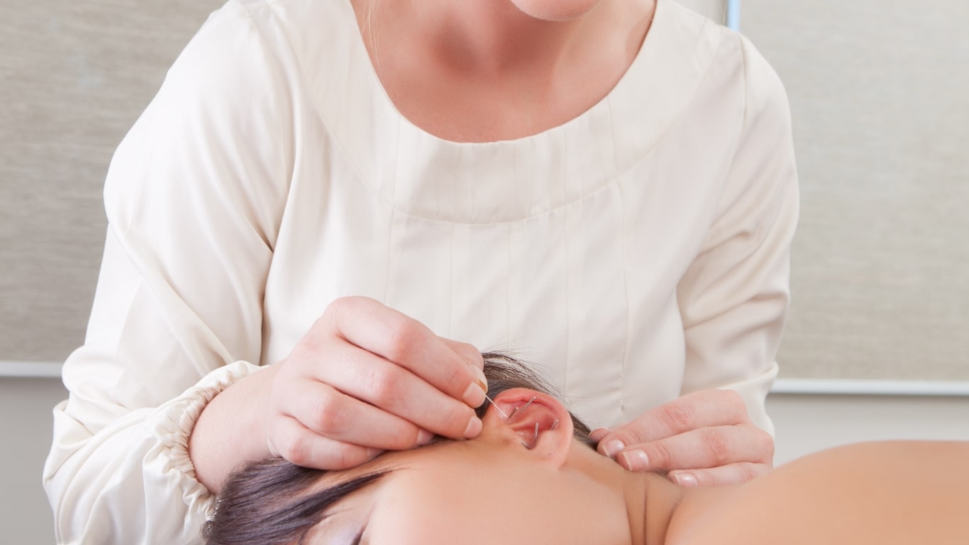 Praticien en acupuncture traitant un patient pour les acouphènes