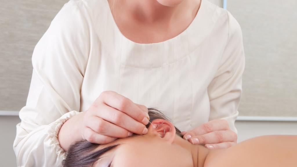 Acupuncture pour les acouphènes